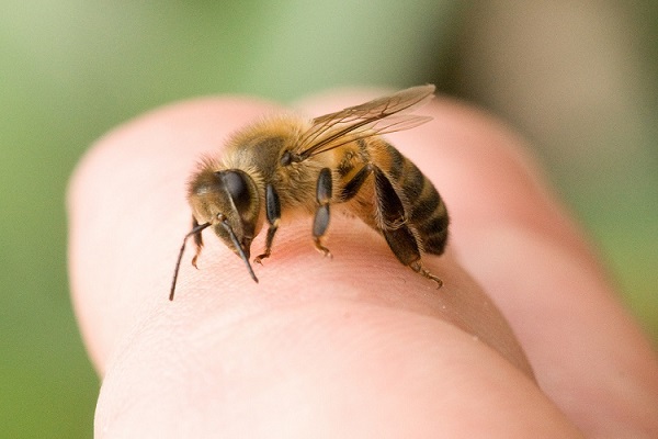 Image result for ‫زنبور گزیدگی‬‎