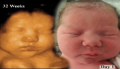 نارسایی و سقط جنین در اثر تجویز سونوگرافی‌های چند بُعدی مکرر