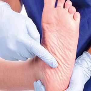 سلامت و بهداشت پا در بیماران مبتلا به دیابت
