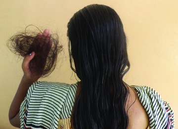 فیلم دکترهمه: ریزش مو پس از ابتلا به کورونا