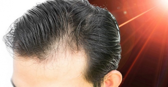 درمان خانگی و طبیعی برای ریزش مو قسمت سوم