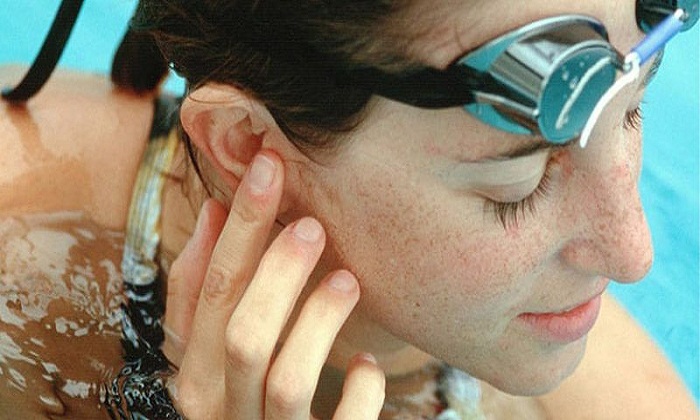 بیماری گوش شناگران یا عفونت گوش خارجی چیست؟