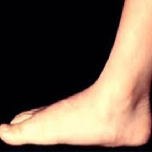 صاف شدن کف پا با افزایش سن
