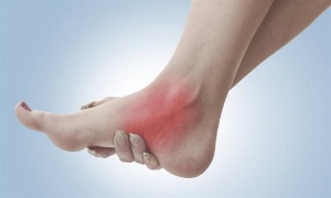 التهاب فاشیای کف پا چگونه درمان می شود؟