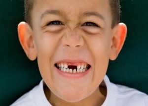مراقبتهای بعد از کشیدن دندان کودکان
