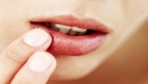 تولید دارویی جهت رفع تب‌خال در ۳دقیقه