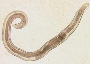 کرمک درکودکان با اقتباس از CDC امریکا