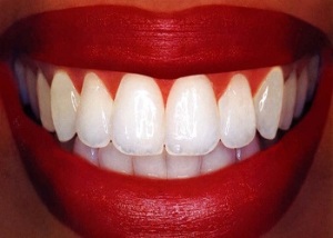راهکارهای داشتن دندان‌ها ی سفیدتر ودرخشان تر