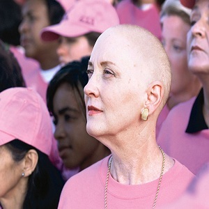 به کدام علایم دیررس سرطان سینه توجه کنیم؟