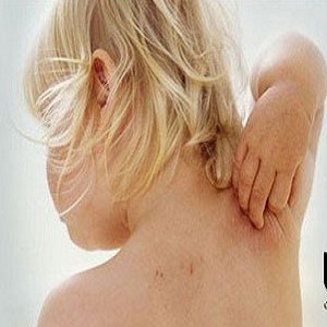انواع درماتیت پوستی و روش درمان آنها