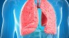 آیا عفونت ریه قابل سرایت است ؟